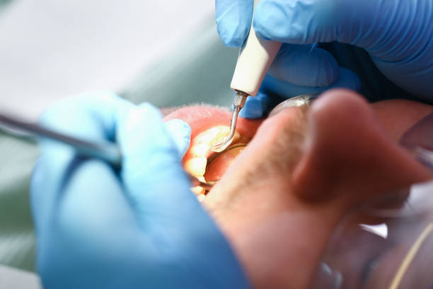 Best Emergency Treatment for Oral Infections in High Rolls, NM